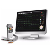 Edan SE1515 PC-Based Wired Stress ECG System