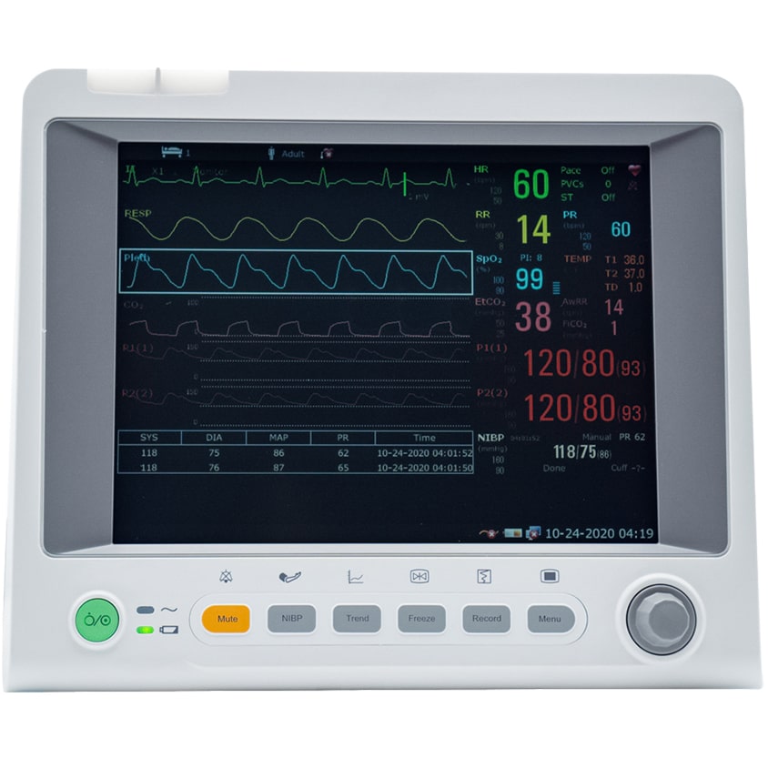 Edan iM60 patient monitor with 10.4 inch display